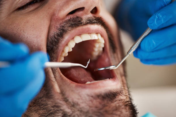 Best Knocked-Out Tooth Emergency  in Merion Station, PA